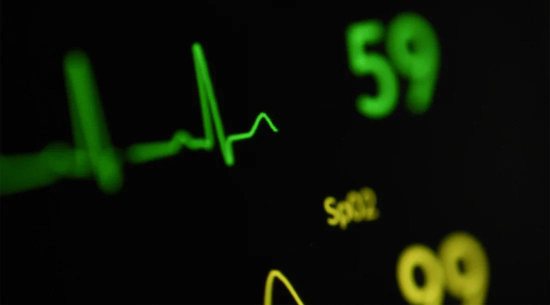 ECG vs EKG: What’s the Difference &amp; Why It Matters for Your Daily Health